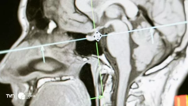 Imagen ilustrativa del cerebro humano mostrando conexiones neuronales.