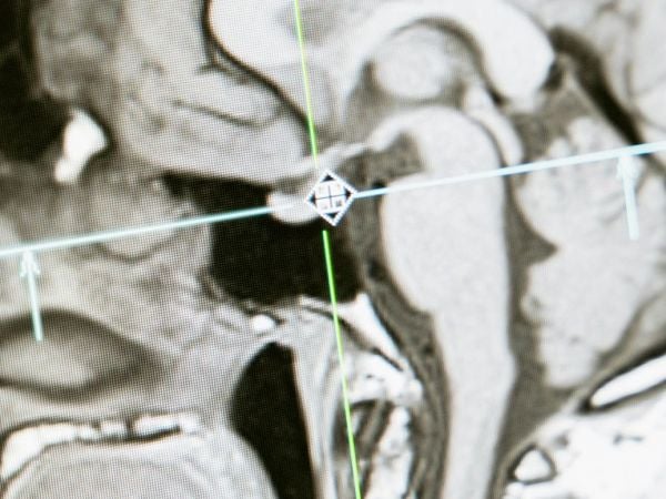 Imagen ilustrativa del cerebro humano mostrando conexiones neuronales.