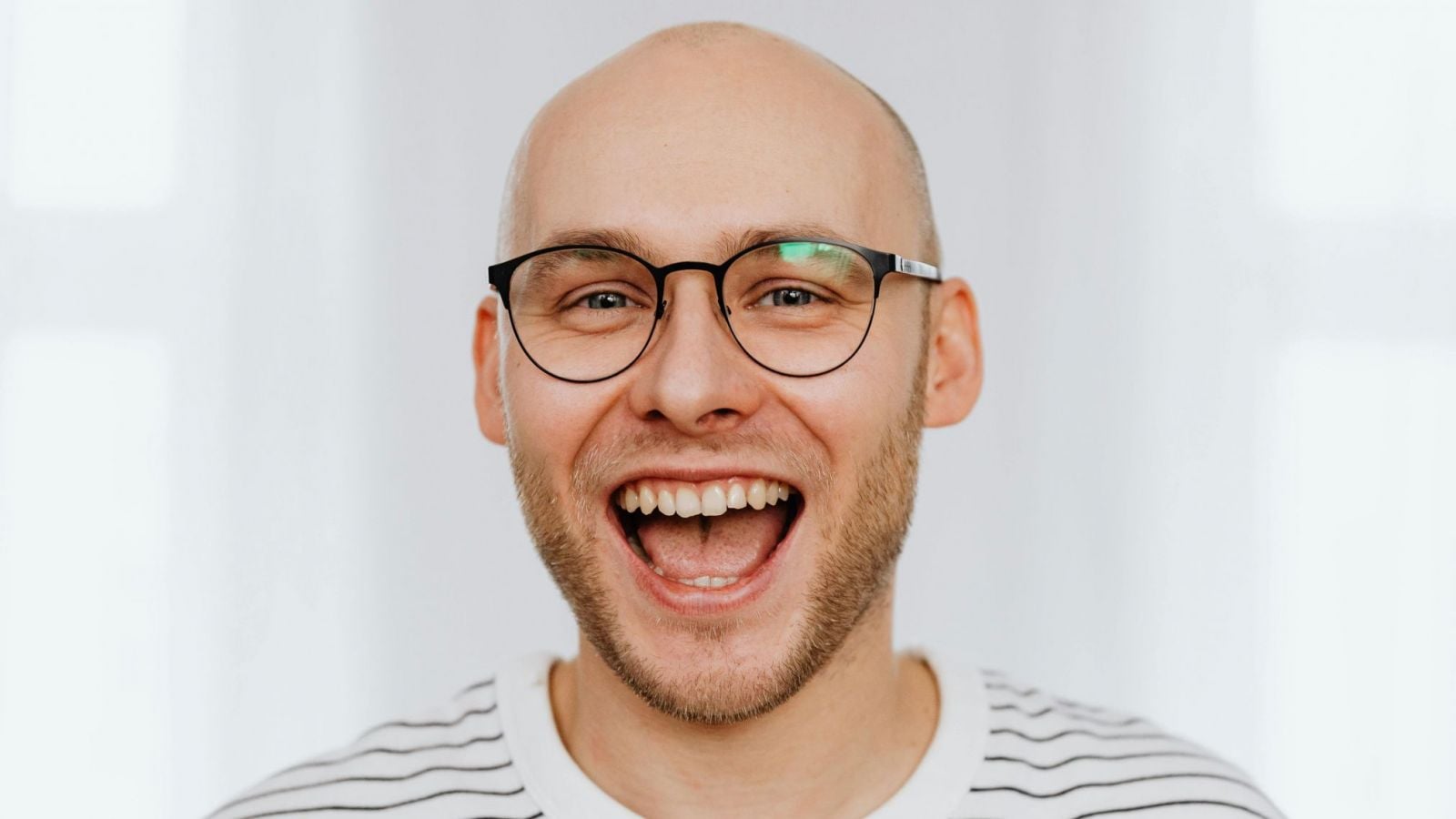 Doctora aclara rumor sobre la creatina y la alopecia