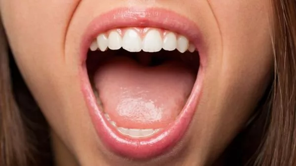 Boca. Cáncer oral