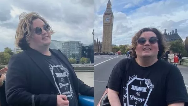 Cambio físico de Nicolás Yunge