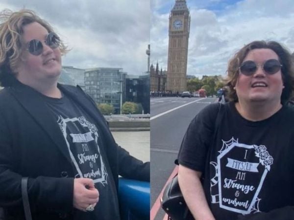 Cambio físico de Nicolás Yunge