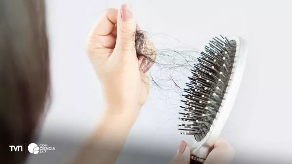 Perdida de pelo.