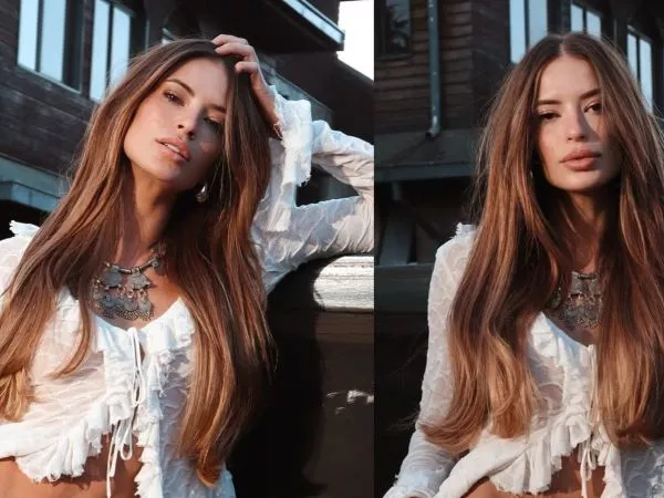 ANTES y DESPUÉS de Julia Fernandes tras cirugía en su cara