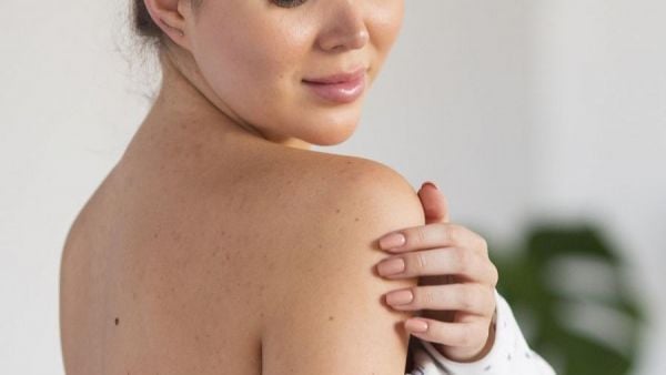 Dermatóloga entrega recomendaciones para cuidar la piel este verano