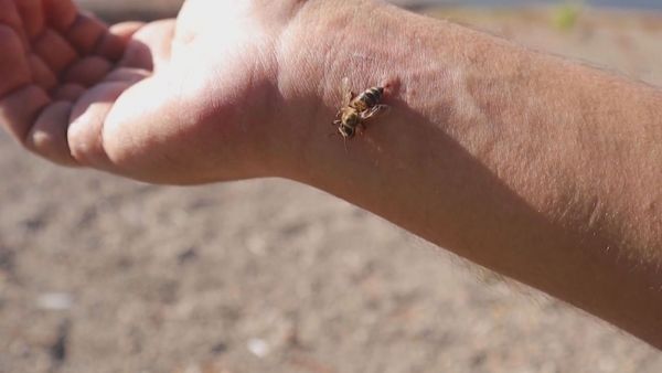 ¿Cómo una picadura de abeja puede provocar un shock anafiláctico?