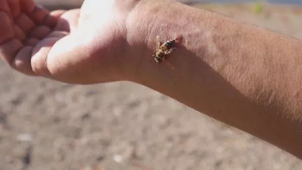 ¿Cómo una picadura de abeja puede provocar un shock anafiláctico?