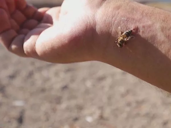 ¿Cómo una picadura de abeja puede provocar un shock anafiláctico?