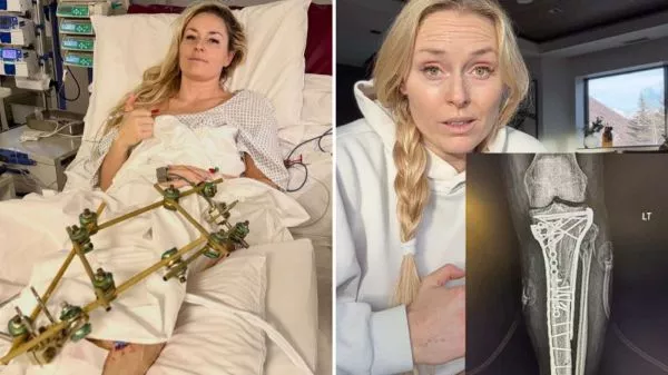 Lindsey Vonn contando sobre la compleja lesión que sufrió en los Juegos Olímpicos