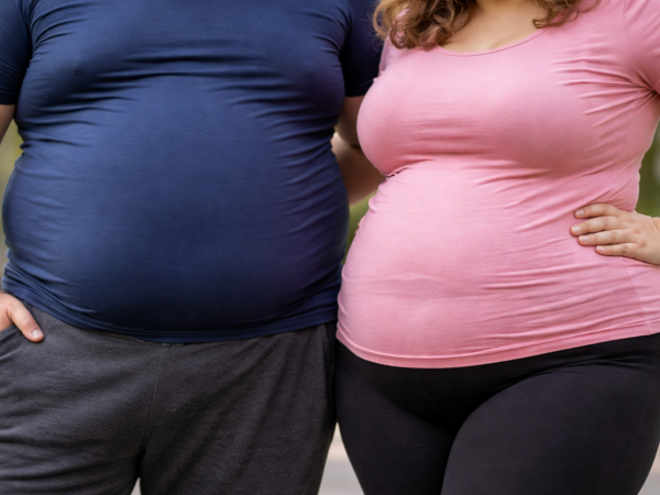 Obesidad. Foto creada con Inteligencia Artificial.