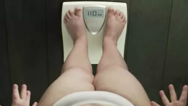 obesidad