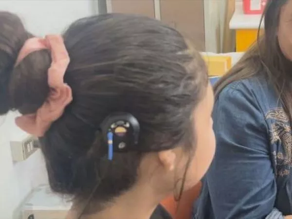 Implante óseo permite a niña escuchar todos los sonidos