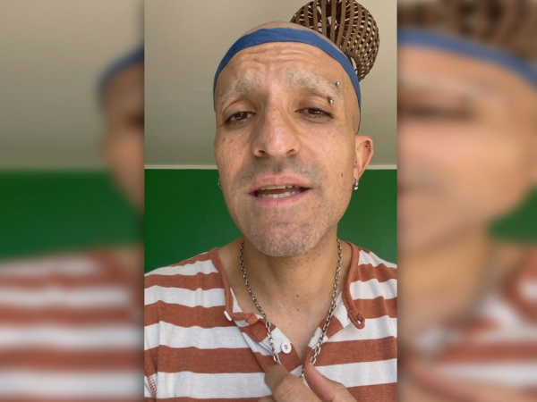 Qué le pasó a Rodrigo Rojas Vade: Tenía rayados políticos en brazos