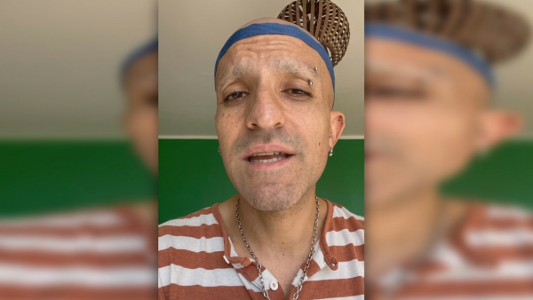 Qué le pasó a Rodrigo Rojas Vade: Tenía rayados políticos en brazos