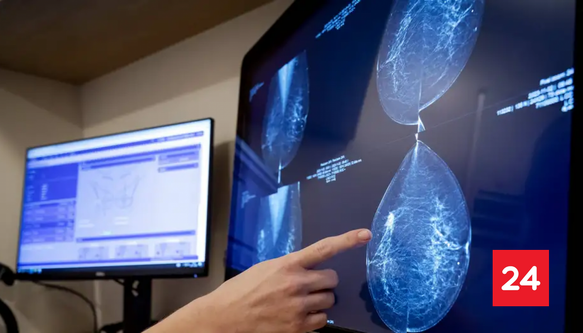 Cáncer de mama: la IA revela lo invisible para los médicos