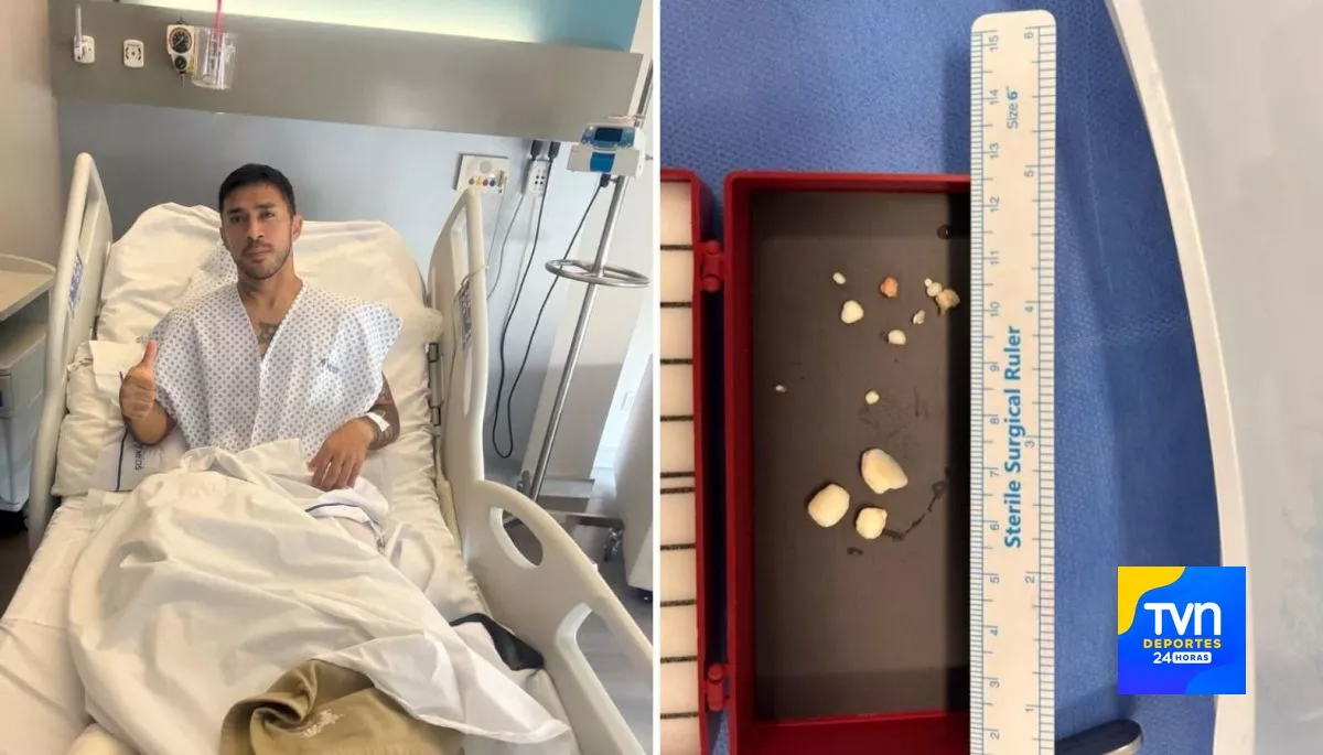 "No esperaba que esto terminara en una operación… me pilló de sorpresa y me bajoneó demasiado"