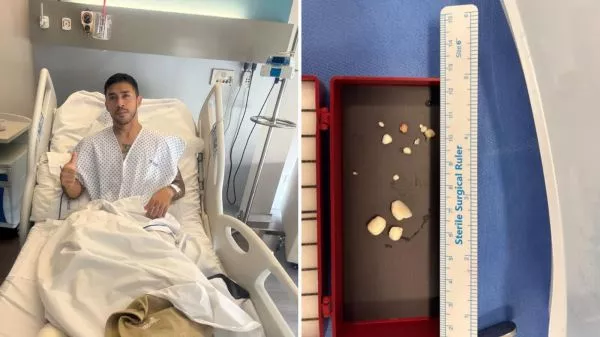 Edson puch tras su operación de tobillo y los fragmentos que le retiraron de este