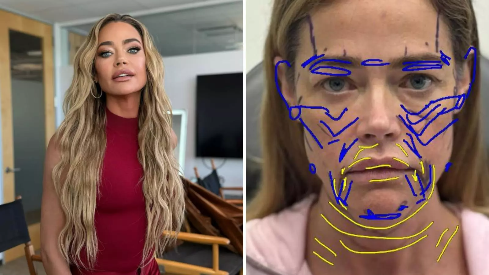 Denise Richards y su cambio tras cirugía estética