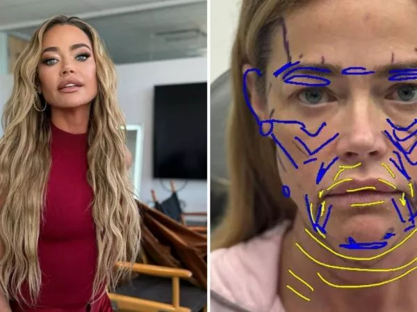 Denise Richards y su cambio tras cirugía estética