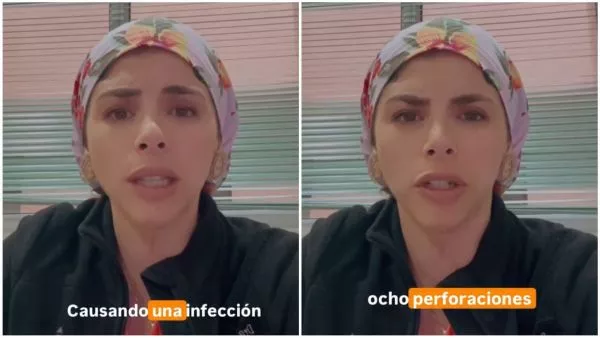 cirujana enciende alerta por reto viral de tragar imanes