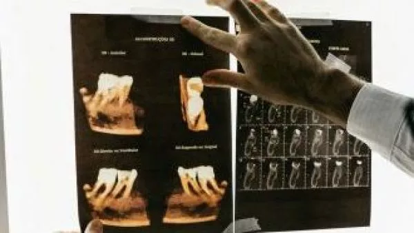 dentista punta arenas