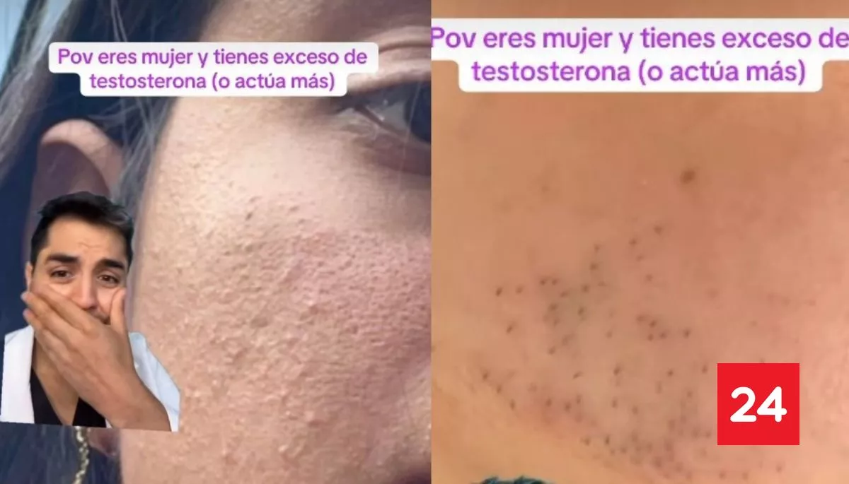 #Bienestar 

¿Eres mujer y tienes la testosterona alta? 6 señales de alerta 

Más detalles ⬇️