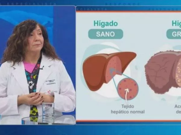 El Especialista Responde: Todo sobre el hígado graso