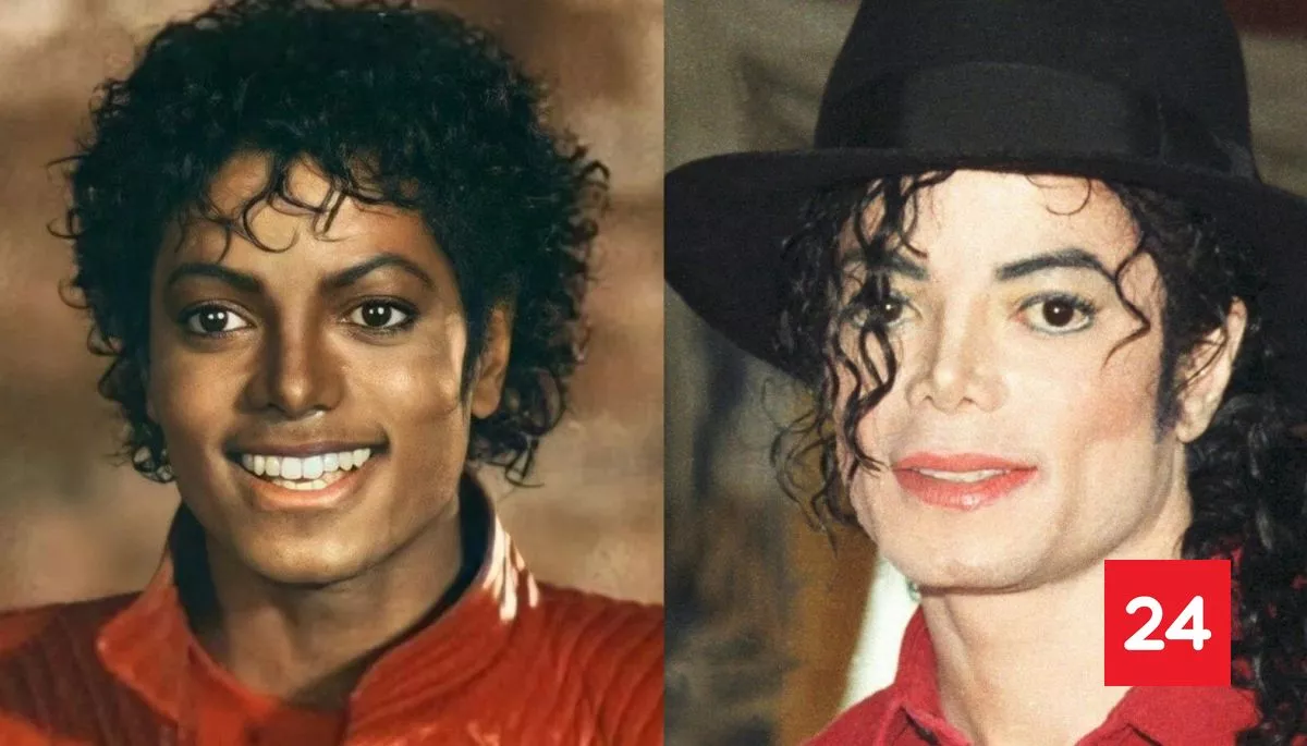 #Bienestar 

El vitíligo, la incomprendida enfermedad que cambió para siempre a Michael Jackson 

Más detalles⬇️