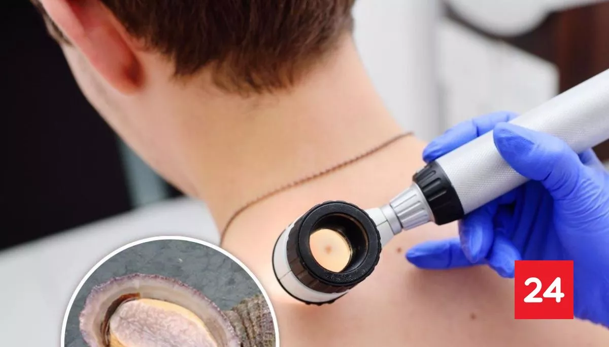 #TecnologíayCiencias 

Con proteína de locos: vacuna chilena contra el melanoma logra prometedores resultados en humanos 

Más detalles⬇️