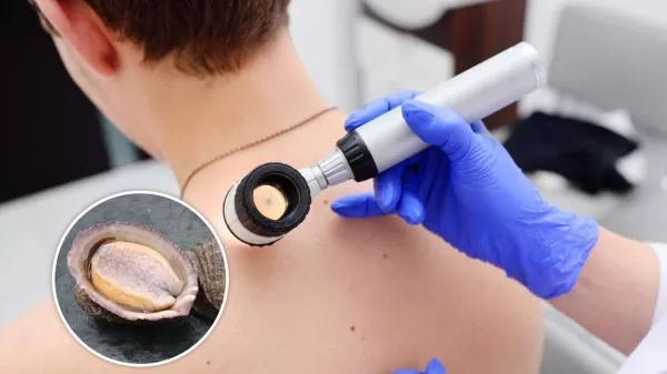 Un loco junto a una persona que es evaluada por un posible cáncer a la piel