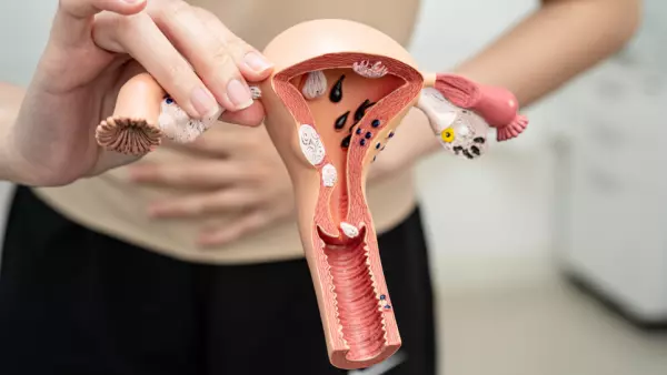 Cáncer de ovario: Síntomas, alertas y cómo tratarlo