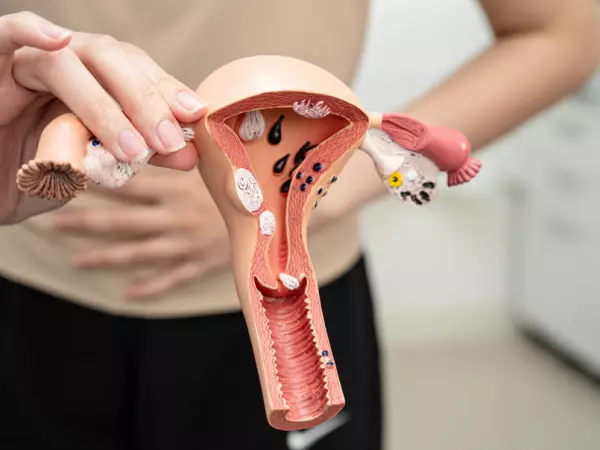 Cáncer de ovario: Síntomas, alertas y cómo tratarlo