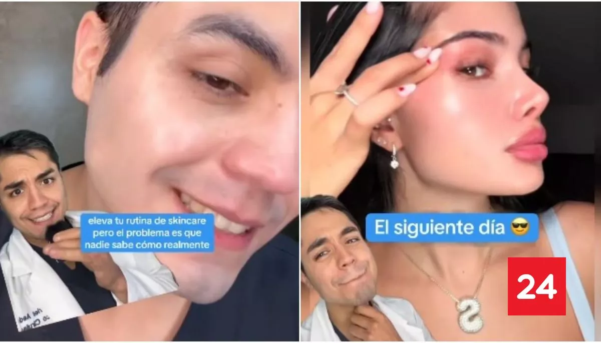 #Bienestar

"Es muy económico": Dermatólogo revela el ingred