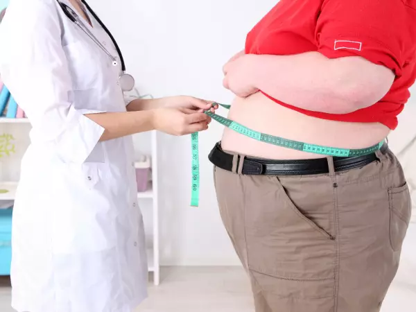 Obesidad en adultos