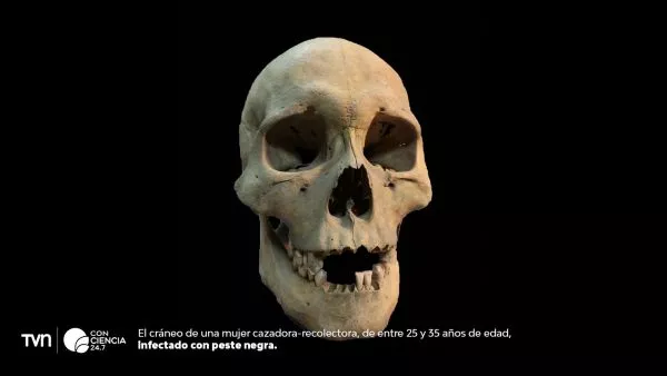 Descubren el brote de peste más antiguo conocido.