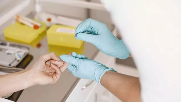 Tras preocupante alza de casos de sífilis: ¿Dónde puedes realizarte gratis una prueba de ITS?