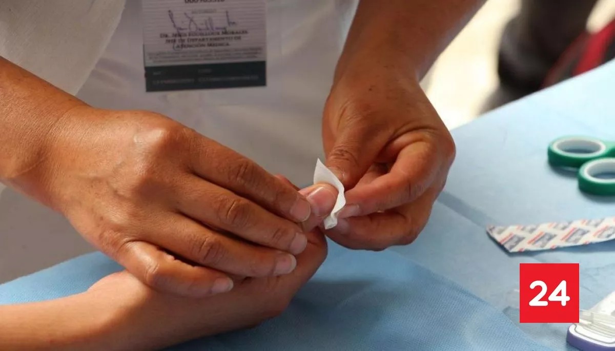 Minsal confirma caso de sarampión en la RM: cuáles son los síntomas y prevención