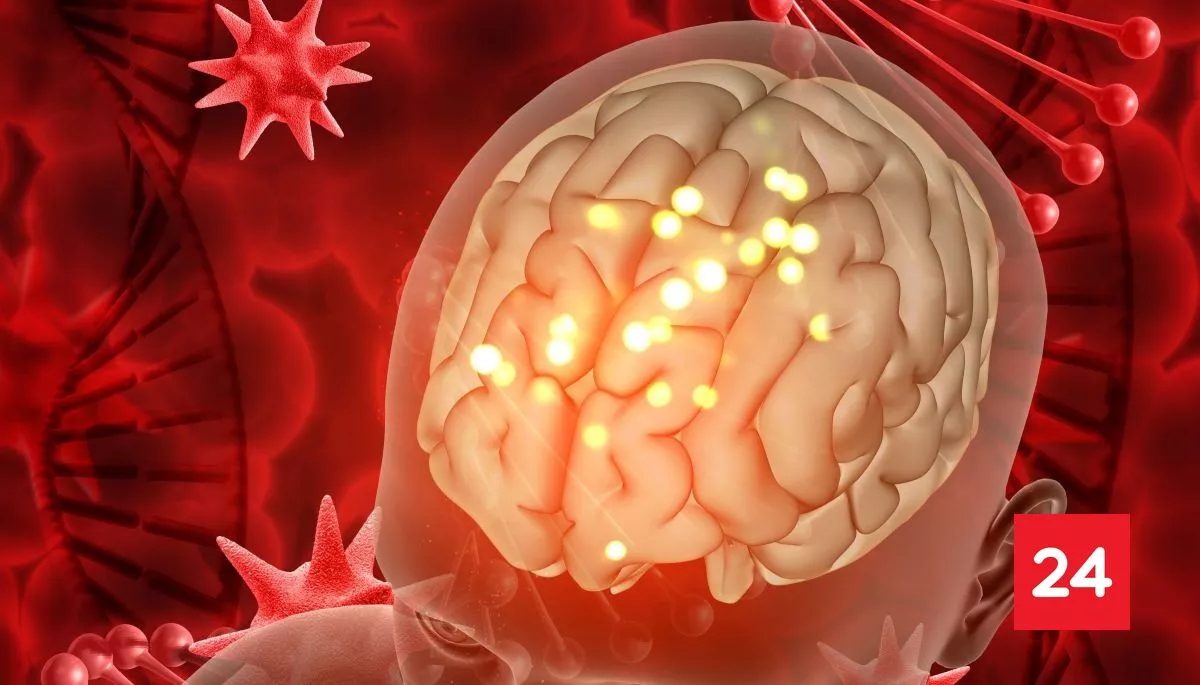 Meningitis: síntomas y que és la enfermedad catalogada "devastadora" por la OMS